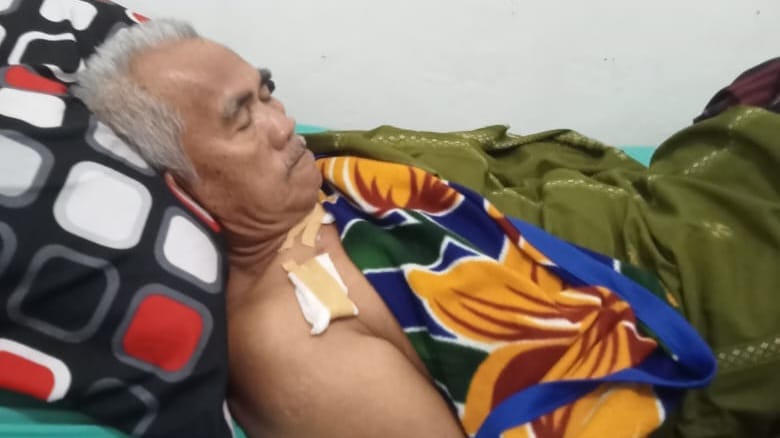 Warga Semaka Tanggamus Lawan Buaya dan Alami Luka Robek